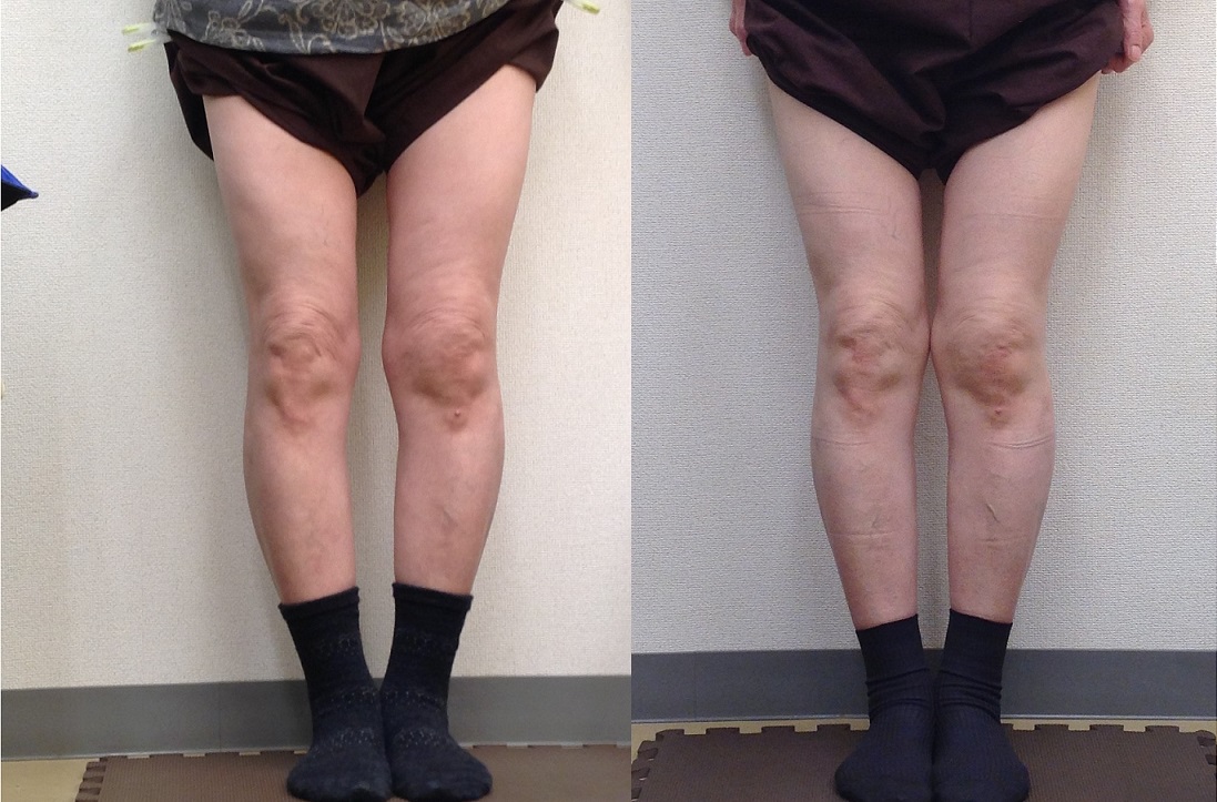 はり,きゅう,足踏み,吸角,整体,総合治療